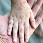 گزارش جدید سازمان جهانی بهداشت؛