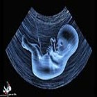 گلایه یک متخصص ژنتیک پزشکی؛